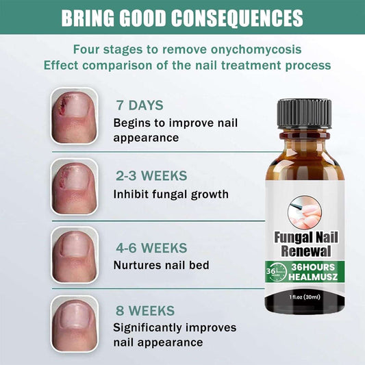 Fungal Nail Renewal 30Ml (Pack of 2)